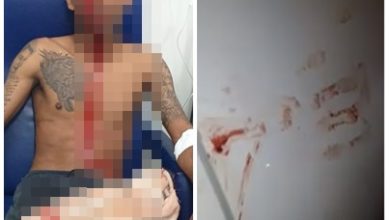 Assaltante baleado no rosto durante tentativa de assalto