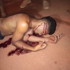 Disparo acertou a cabeça da vítima que morreu no local