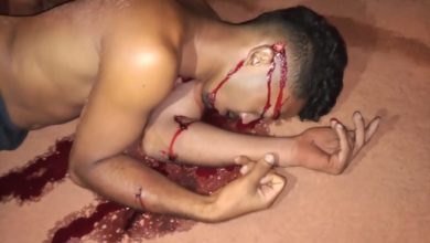 Disparo acertou a cabeça da vítima que morreu no local