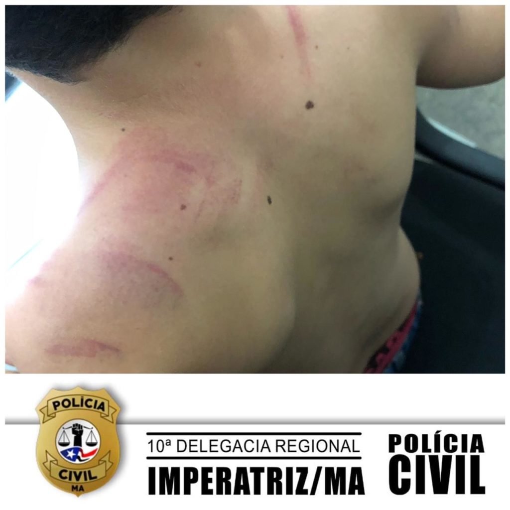 Divulgação PCMA