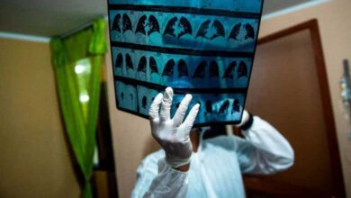 Coronavírus como pacientes 'resistentes' podem ajudar na busca por tratamento para covid-19