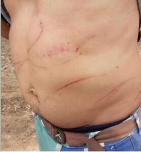 Vítima ficou com escoriações pelo corpo