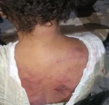 Mulher foi agredida pelo ex-companheiro