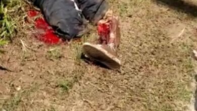 Motociclista sofreu fratura exposta pelo corpo
