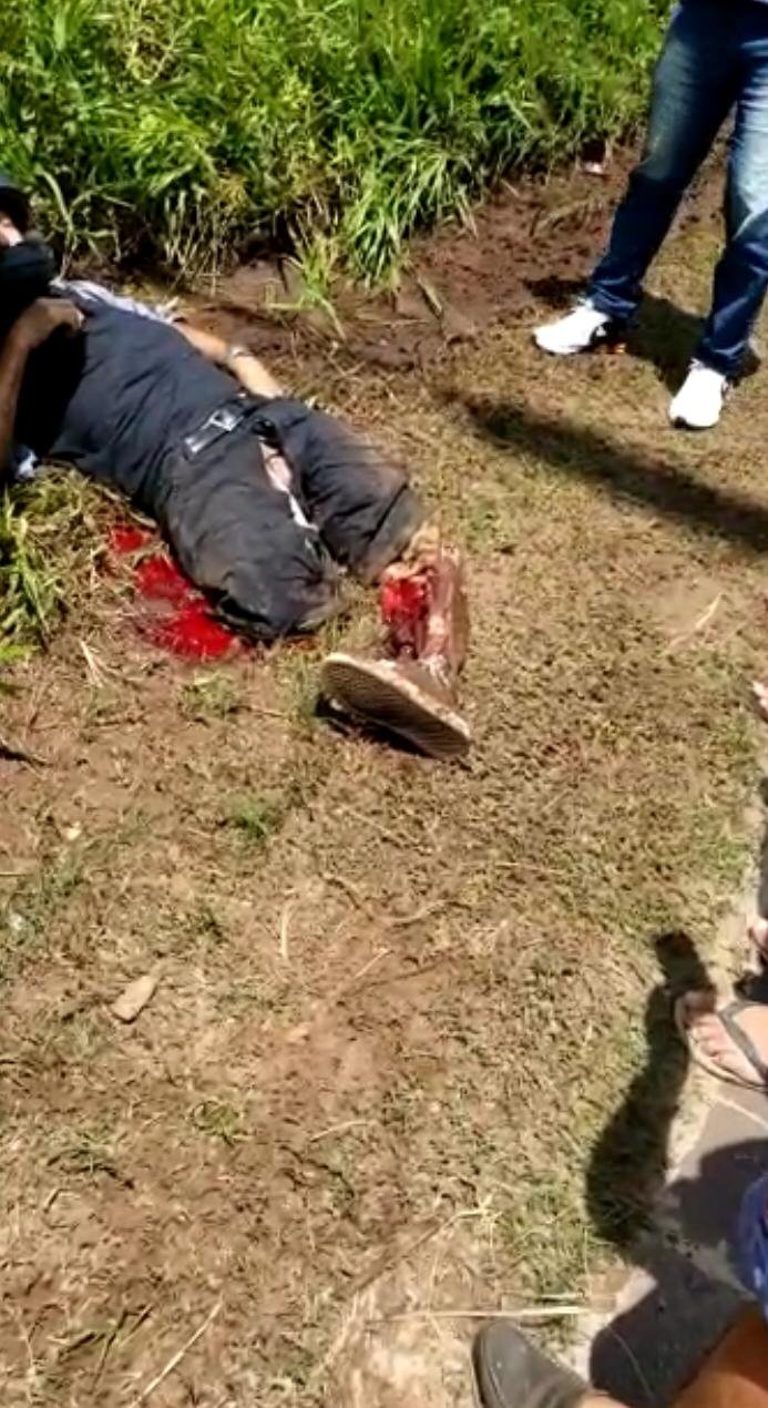 Motociclista sofreu fratura exposta pelo corpo