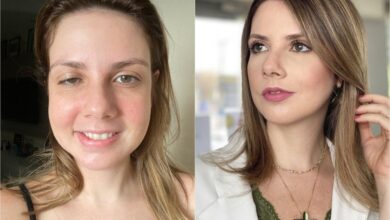 Vida pós-Covid no Maranhão recuperados sofrem com sequelas deixadas pelo coronavírus após vencerem fase aguda da doença