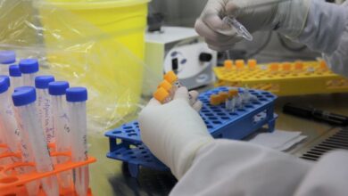 76 profissionais da saúde já morreram no Maranhão; veja os números da pandemia no estado