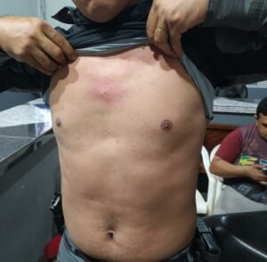 Policial foi protegido pelo colete balístico